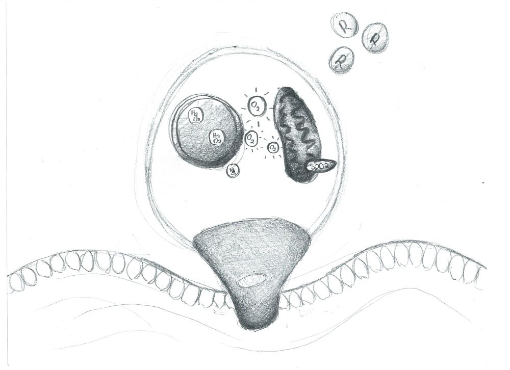 SOD2 model sketch